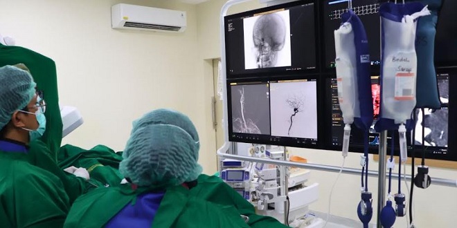 Tim medis bersama saat pendampingan operasi coiling aneurisma perdana di RSUD Drs. H. Amri Tambunan